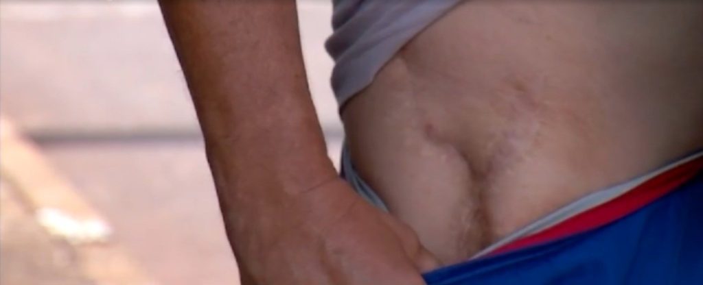 Suspensão de cirurgias eletivas deixa pacientes com medo: ‘Perigoso pegar bactéria’